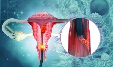 भारत में हर 8 मिनट में सर्वाइकल कैंसर से एक महिला की मौत: AIIMS–ICMR रिपोर्ट